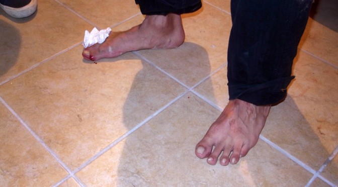 NICOLA ANTONELLI'S FEET AFTER THE PERFORMANCE